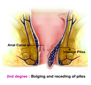 Bishop recommendet Glory hole location listings